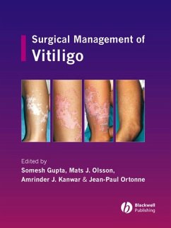 Surgical Management of Vitiligo (eBook, PDF)