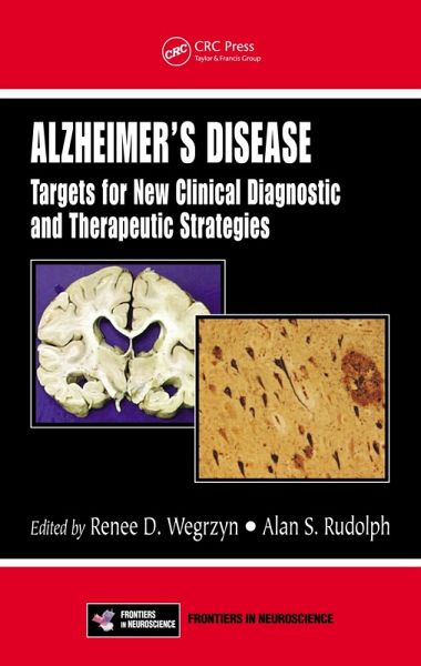 Alzheimer's Disease (eBook, PDF) Alzheimer's Disease (eBook, PDF)