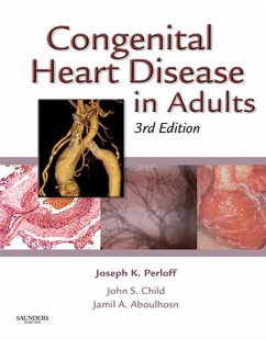 Congenital Heart Disease in Adults (eBook, ePUB) Cover Congenital Heart Disease in Adults (eBook, ePUB)