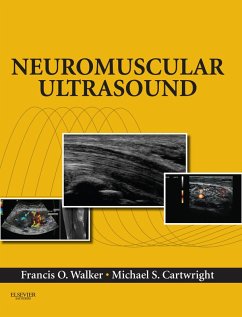 Neuromuscular Ultrasound E-Book (eBook, ePUB) - Walker, Francis; Cartwright, Michael S.