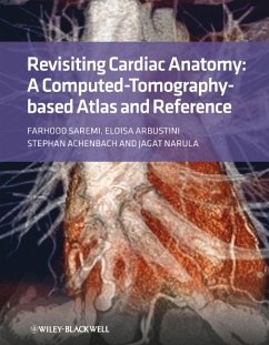Revisiting Cardiac Anatomy (eBook, ePUB) - Saremi, Farhood