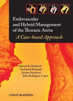 Endovascular and Hybrid Management of the Thoracic Aorta (eBook, ePUB) - Diethrich, Edward B.; Ramaiah, Venkatesh; Kpodonu, Jacques; Rodriguez-Lopez, Julio A.