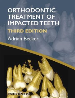 Orthodontic Treatment of Impacted Teeth (eBook, ePUB) - Becker, Adrian