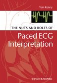 The Nuts and bolts of Paced ECG Interpretation (eBook, ePUB)