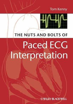 The Nuts and bolts of Paced ECG Interpretation (eBook, ePUB) - Kenny, Tom