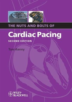 The Nuts and Bolts of Cardiac Pacing (eBook, ePUB) - Kenny, Tom