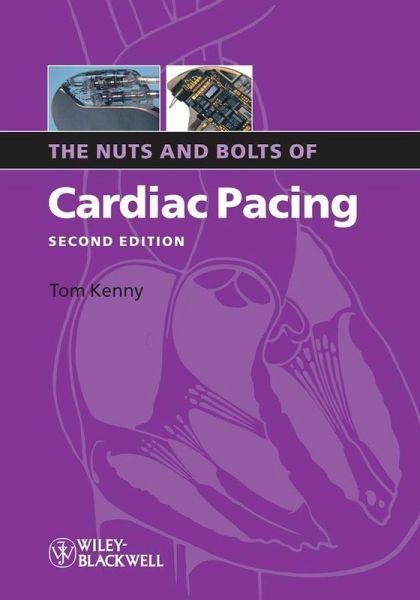 The Nuts and Bolts of Cardiac Pacing (eBook, ePUB) The Nuts and Bolts of Cardiac Pacing (eBook, ePUB)