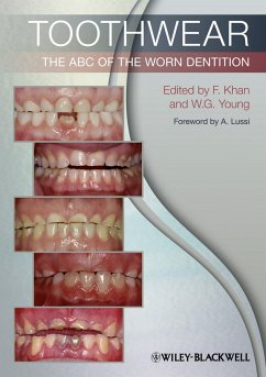 Toothwear (eBook, PDF)