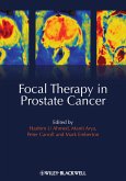 Focal Therapy in Prostate Cancer (eBook, PDF)