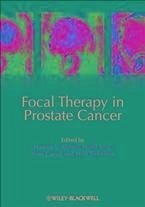Cover Focal Therapy in Prostate Cancer (eBook, PDF)