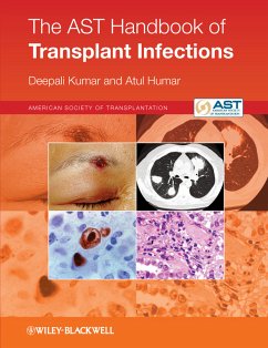 The AST Handbook of Transplant Infections (eBook, ePUB) - Kumar, Deepali; Humar, Atul