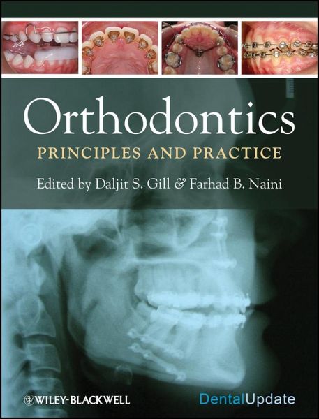 Orthodontics (eBook, ePUB)