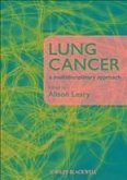 Lung Cancer (eBook, PDF)