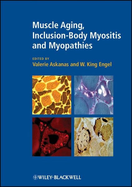Muscle Aging, Inclusion-Body Myositis and Myopathies (eBook, PDF)
