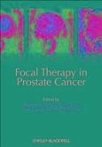 Focal Therapy in Prostate Cancer (eBook, ePUB)