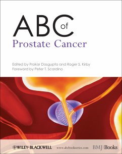 ABC of Prostate Cancer (eBook, PDF) - Dasgupta, Prokar; Kirby, Roger S.