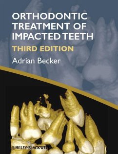 Cover Orthodontic Treatment of Impacted Teeth (eBook, PDF)