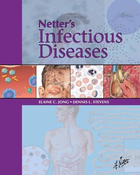 Netter's Infectious Diseases E-Book (eBook, ePUB)