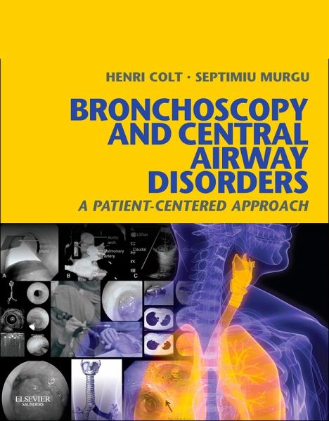 Bronchoscopy and Central Airway Disorders E-Book (eBook, ePUB) Bronchoscopy and Central Airway Disorders E-Book (eBook, ePUB)