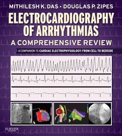 Electrocardiography of Arrhythmias: A Comprehensive Review E-Book (eBook, ePUB) - Das, Mithilesh Kumar; Das, Mithilesh Kumar; Zipes, Douglas P.; Zipes, Douglas P.