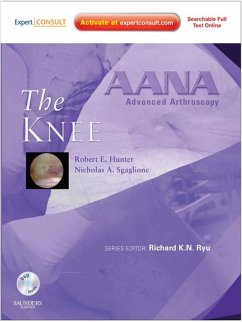 AANA Advanced Arthroscopy: The Knee E-Book (eBook, ePUB) - Hunter, Robert E.; Sgaglione, Nicholas A.