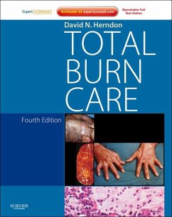 Cover Total Burn Care (eBook, ePUB)