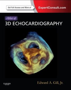 Atlas of 3D Echocardiography E-Book (eBook, ePUB) - Gill, Edward A.; Sugeng, Lisa; Lang, Roberto
