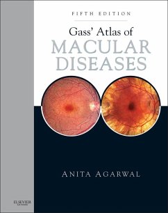 Gass' Atlas of Macular Diseases E-Book (eBook, ePUB) - Agarwal, Anita