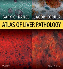 Atlas of Liver Pathology E-Book (eBook, ePUB) - Kanel, Gary C.; Korula, Jacob