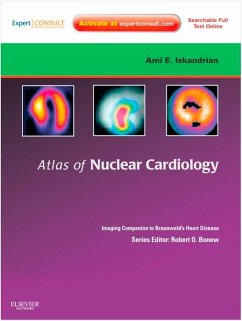 Atlas of Nuclear Cardiology: Imaging Companion to Braunwald's Heart Disease E-Book (eBook, ePUB) - Iskandrian, Ami E.; Garcia, Ernest V.