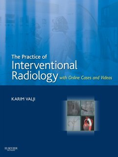 The Practice of Interventional Radiology, with Online Cases and Video E-Book (eBook, ePUB) - Valji, Karim