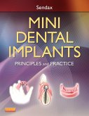 Mini Dental Implants (eBook, ePUB)