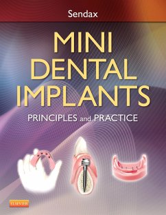 Mini Dental Implants (eBook, ePUB) - Sendax, Victor