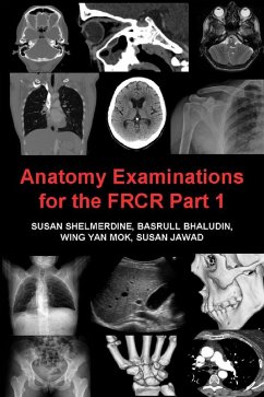 Anatomy Examinations for the FRCR Part 1 (eBook, PDF) - Shelmerdine, Susan