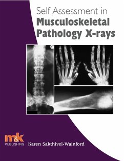 Self Assessment in Musculoskeletal Pathology X-rays (eBook, ePUB) Cover Self Assessment in Musculoskeletal Pathology X-rays (eBook, ePUB)