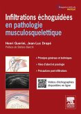 Infiltrations échoguidées (eBook, ePUB) Infiltrations échoguidées (eBook, ePUB)