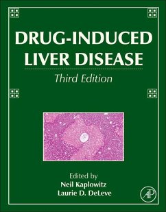 Drug-Induced Liver Disease (eBook, ePUB)