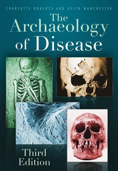 The Archaeology of Disease (eBook, ePUB) - Roberts, Charlotte; Manchester, Keith