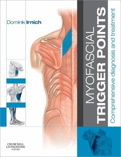 Myofascial Trigger Points (eBook, ePUB) - Irnich MD, Dominik