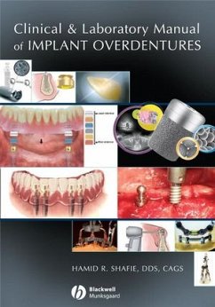 Clinical and Laboratory Manual of Implant Overdentures (eBook, PDF) - Shafie, Hamid R.