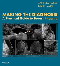 Making the Diagnosis: A Practical Guide to Breast Imaging E-Book (eBook, ePUB) - Harvey, Jennifer; March, David E