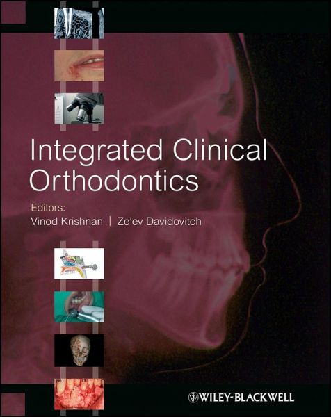 Integrated Clinical Orthodontics (eBook, PDF)
