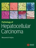 Pathology of Hepatocellular Carcinoma (eBook, PDF)