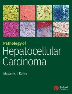 Pathology of Hepatocellular Carcinoma (eBook, PDF) - Kojiro, Masamichi