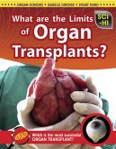 What Are the Limits of Organ Transplantation? (eBook, PDF)