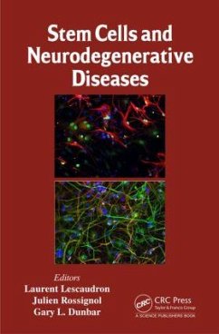 Stem Cells and Neurodegenerative Diseases