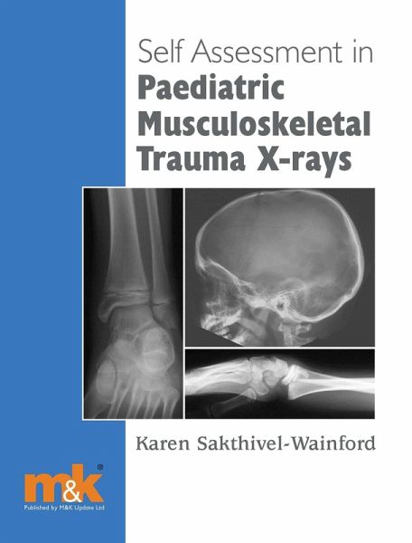 Self-assessment in Paediatric Musculoskeletal Trauma X-rays (eBook, ePUB) Self-assessment in Paediatric Musculoskeletal Trauma X-rays (eBook, ePUB)