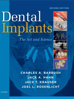 Dental Implants (eBook, ePUB) - Babbush DDS, MScD; Hahn DDS, Jack A.; Krauser DMD, Jack T.; Rosenlicht DMD, Joel L.