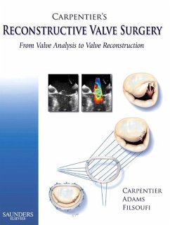 Carpentier's Reconstructive Valve Surgery (eBook, ePUB) - Carpentier, Alain; Adams, David H.; Filsoufi, Farzan