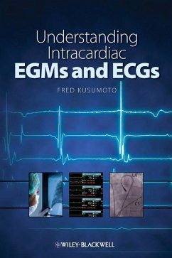 Understanding Intracardiac EGMs and ECGs (eBook, PDF) - Kusumoto, Fred
